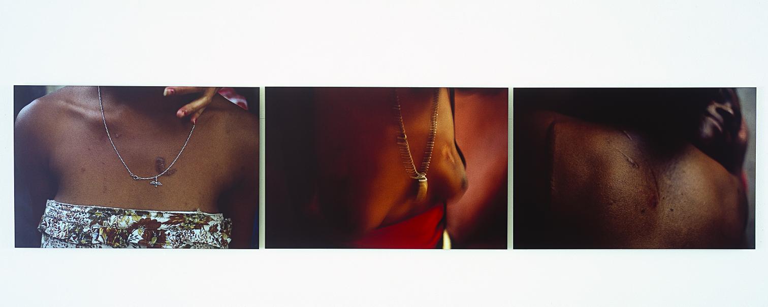 Scar Triptych (1979) - Miguel da Silva Paranhos do Rio Branco - Miguel Rio Branco